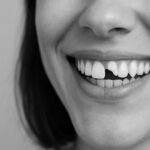 Une femme souriant avec une dent de l'avant brisée, illustrant une erreur de navigation sur le site.